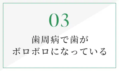 歯周病で歯がボロボロになっている